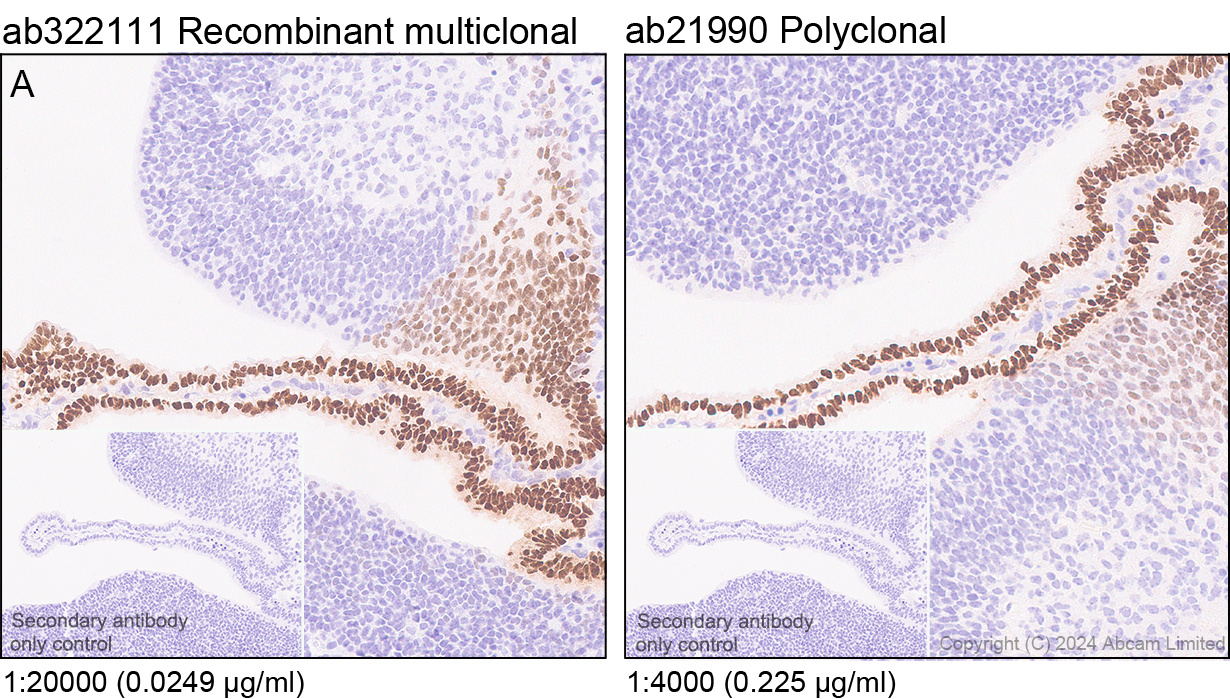 Immunohistochemistry (Formalin/PFA-fixed paraffin-embedded sections) - Anti-Otx1 + Otx2 antibody (ab21990), expandable thumbnail