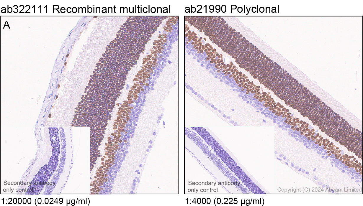 Immunohistochemistry (Formalin/PFA-fixed paraffin-embedded sections) - Anti-Otx1 + Otx2 antibody (ab21990), expandable thumbnail