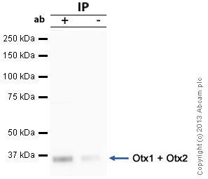 Immunoprecipitation - Anti-Otx1 + Otx2 antibody (AB21990), expandable thumbnail