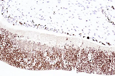 Immunohistochemistry (Formalin/PFA-fixed paraffin-embedded sections) - Anti-Otx2 antibody (AB114138)