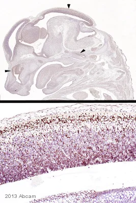 Immunohistochemistry (Formalin/PFA-fixed paraffin-embedded sections) - Anti-Otx2 antibody (AB114138)