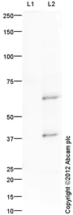 Western blot - Anti-Otx2 antibody (AB114138)