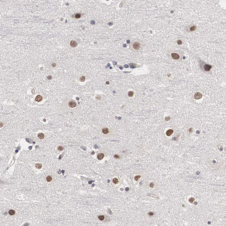 Immunohistochemistry (Formalin/PFA-fixed paraffin-embedded sections) - Anti-OTX2 Antibody (AB327165)