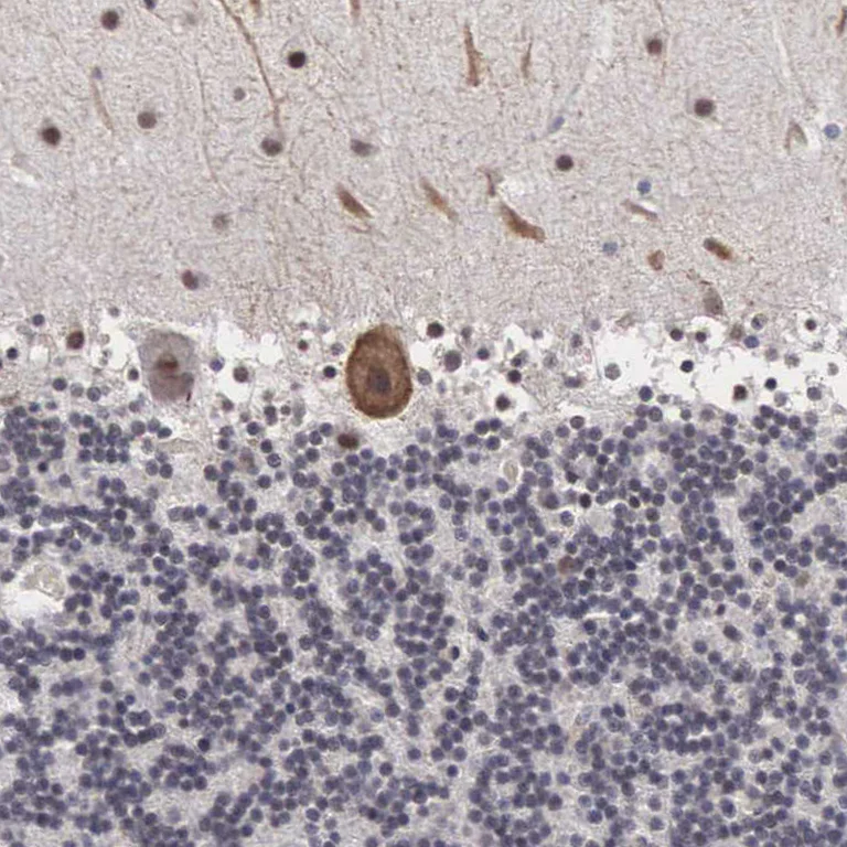 Immunohistochemistry (Formalin/PFA-fixed paraffin-embedded sections) - Anti-OTX2 Antibody (AB327165)