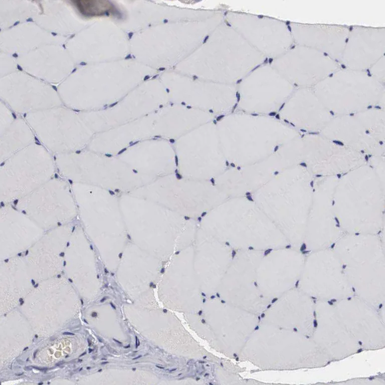 Immunohistochemistry (Formalin/PFA-fixed paraffin-embedded sections) - Anti-OTX2 Antibody (AB327165)