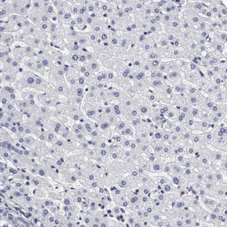 Immunohistochemistry (Formalin/PFA-fixed paraffin-embedded sections) - Anti-OTX2 Antibody (AB327165)