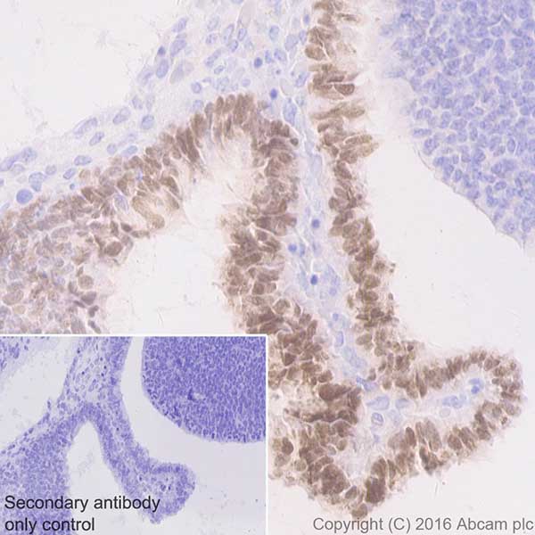 Immunohistochemistry (Formalin/PFA-fixed paraffin-embedded sections) - Anti-Otx2 antibody [EPR20375] (ab183951), expandable thumbnail