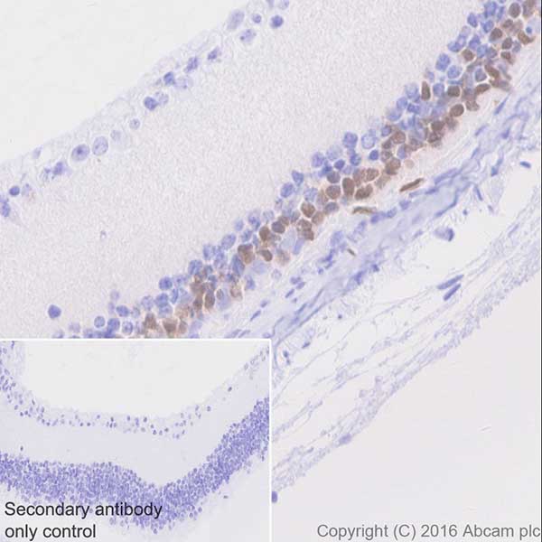 Immunohistochemistry (Formalin/PFA-fixed paraffin-embedded sections) - Anti-Otx2 antibody [EPR20375] (ab183951), expandable thumbnail