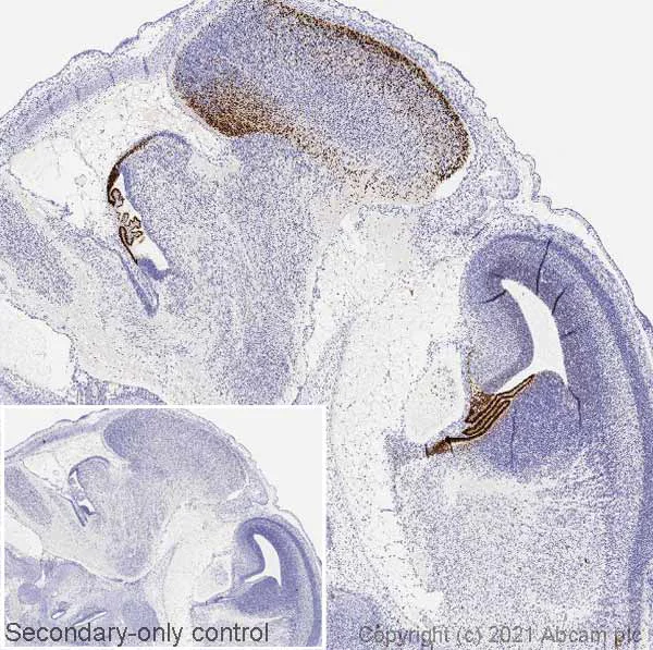 Immunohistochemistry (Formalin/PFA-fixed paraffin-embedded sections) - Anti-Otx2 antibody [EPR20375] (AB183951)