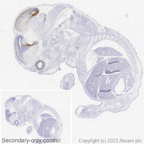 Immunohistochemistry (Formalin/PFA-fixed paraffin-embedded sections) - Anti-Otx2 antibody [EPR20375] (AB183951)