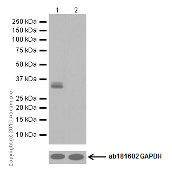Western blot - Anti-Otx2 antibody [EPR20375] (ab183951), expandable thumbnail