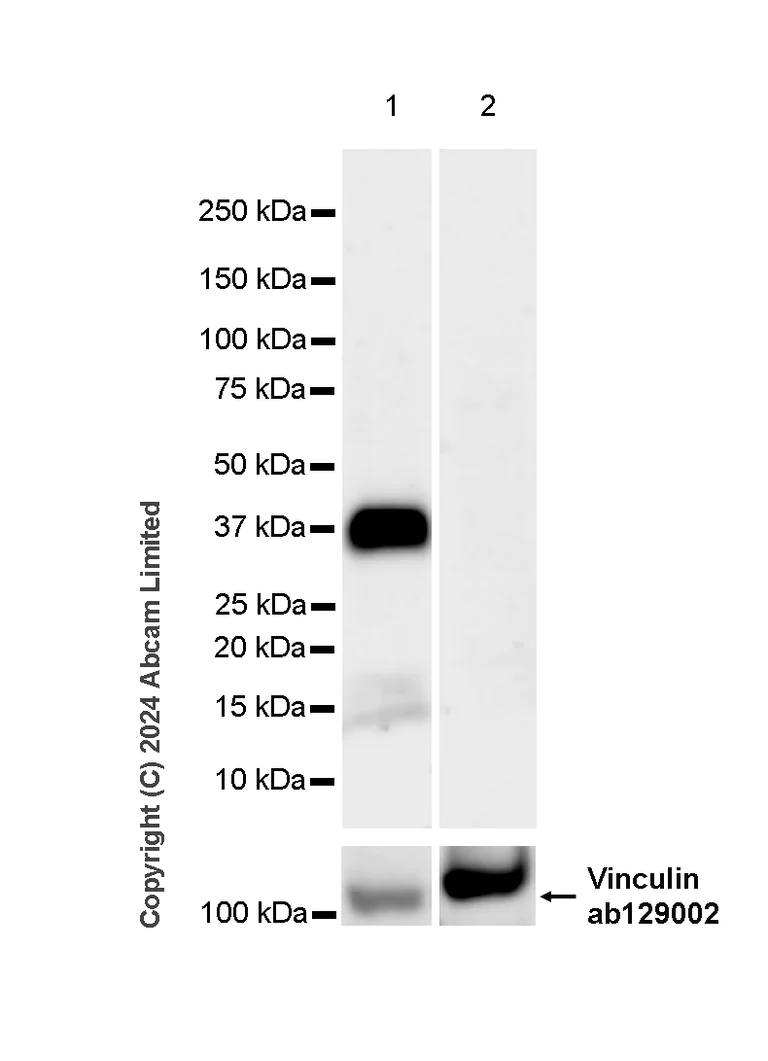 Western blot - Anti-Otx2 antibody [EPR3348] (AB92326)