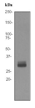 Western blot - Anti-Otx2 antibody [EPR3348] - BSA and Azide free (AB247542), expandable thumbnail