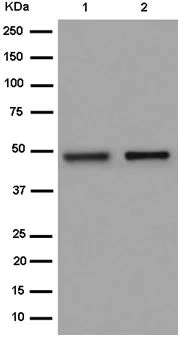 Western blot - Anti-OVCA1 antibody [EPR15342] - BSA and Azide free (AB250862)