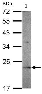 Western blot - Anti-OVCA2 antibody (AB101523)