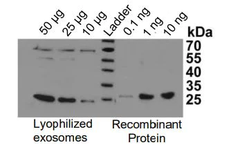 Western blot - Overall Exosome Capture and Quantification Assay Kit (AB287851)