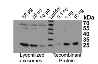 Western blot - Overall Exosome Capture and Quantification Assay Kit (Human Serum, Colorimetric) (AB287861), expandable thumbnail