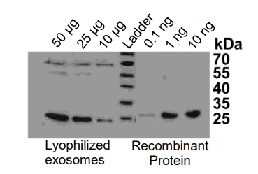 Western blot - Overall Exosome Capture and Quantification ELISA Assay Kit (AB285284), expandable thumbnail