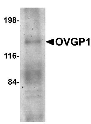 Western blot - Anti-OVGP1/OGP antibody (AB74544)