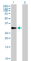 Western blot - Anti-OVOL1 antibody (AB172053)