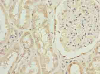 Immunohistochemistry (Formalin/PFA-fixed paraffin-embedded sections) - Anti-OVOL1 antibody (AB235949), expandable thumbnail