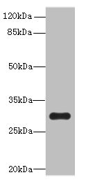 Western blot - Anti-OVOL1 antibody (AB235949), expandable thumbnail