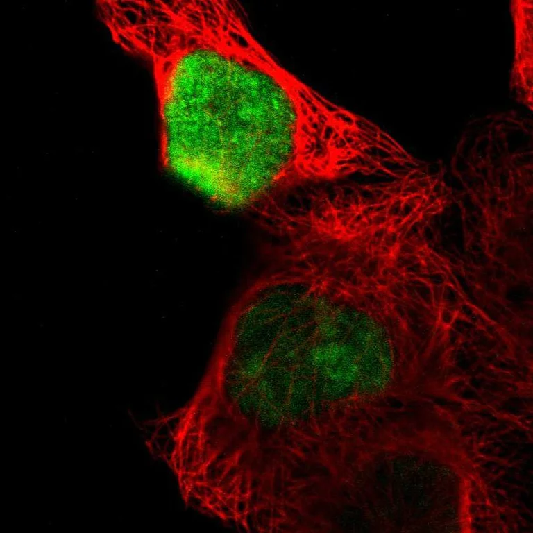 Immunocytochemistry/ Immunofluorescence - Anti-OVOL1 antibody (AB246873)