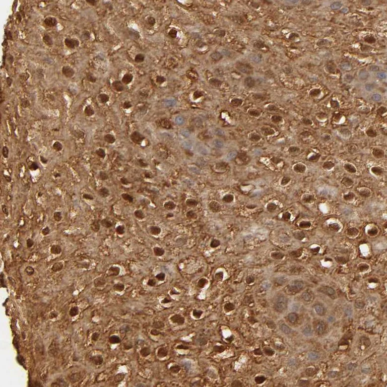Immunohistochemistry (Formalin/PFA-fixed paraffin-embedded sections) - Anti-OVOL1 antibody (AB246873)