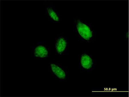 Immunocytochemistry/ Immunofluorescence - Anti-OVOL2 antibody (AB169469)