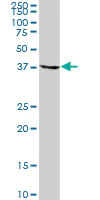 Western blot - Anti-OXA1L antibody (AB88975)