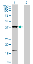 Western blot - Anti-OXA1L antibody (AB88975), expandable thumbnail