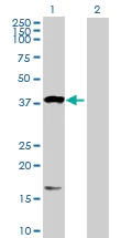 Western blot - Anti-OXA1L antibody (AB88975)