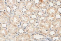 Immunohistochemistry (Formalin/PFA-fixed paraffin-embedded sections) - Anti-OXCT1/SCOT antibody (AB105320)