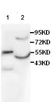 Western blot - Anti-OXCT1/SCOT antibody (AB105320)