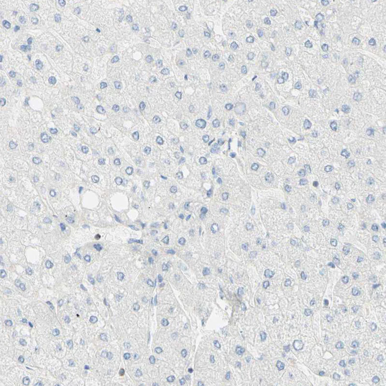 Immunohistochemistry (Formalin/PFA-fixed paraffin-embedded sections) - Anti-OXCT1/SCOT antibody (AB224250)