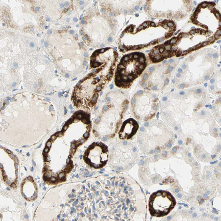 Immunohistochemistry (Formalin/PFA-fixed paraffin-embedded sections) - Anti-OXCT1/SCOT antibody (AB224250)
