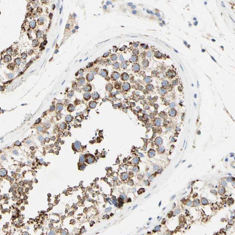 Immunohistochemistry (Formalin/PFA-fixed paraffin-embedded sections) - Anti-OXCT1/SCOT antibody (AB224250)