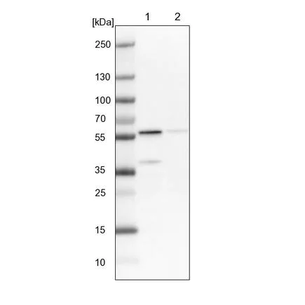 Western blot - Anti-OXCT1/SCOT antibody (AB224250)