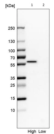 Western blot - Anti-OXCT1/SCOT antibody (AB224250)