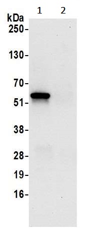 Immunoprecipitation - Anti-OXCT1/SCOT antibody (AB241125), expandable thumbnail