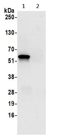 Immunoprecipitation - Anti-OXCT1/SCOT antibody (AB241125)