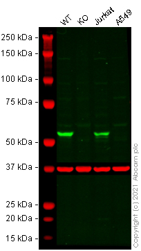 Western blot - Anti-OXCT1/SCOT antibody (AB241125), expandable thumbnail