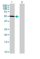 Western blot - Anti-OXCT1/SCOT antibody (AB70413)