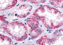 Immunohistochemistry (Formalin/PFA-fixed paraffin-embedded sections) - Anti-OXGR1/GPR99 antibody (AB67351)
