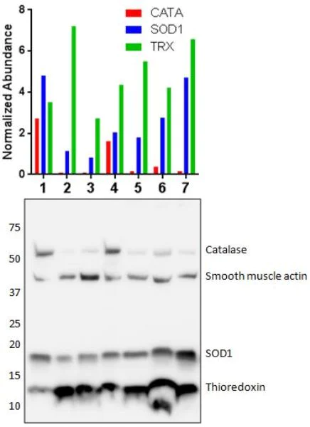 Western blot - Oxidative Stress Defense (Catalase, SOD1, TRX, smooth muscle Actin) Western Blot Cocktail (AB179843)