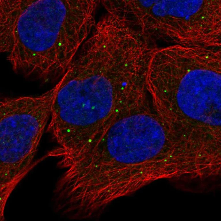 Immunocytochemistry/ Immunofluorescence - Anti-OXR1 antibody (AB251774)