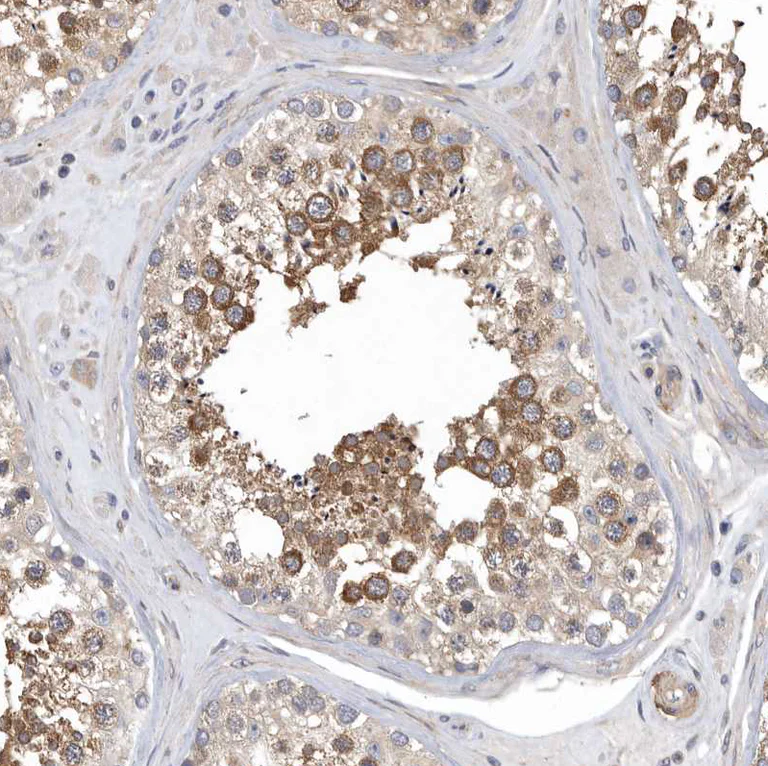 Immunohistochemistry (Formalin/PFA-fixed paraffin-embedded sections) - Anti-OXR1 antibody (AB251774)