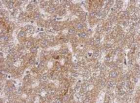 Immunohistochemistry (Formalin/PFA-fixed paraffin-embedded sections) - Anti-OXSM antibody (AB154616)