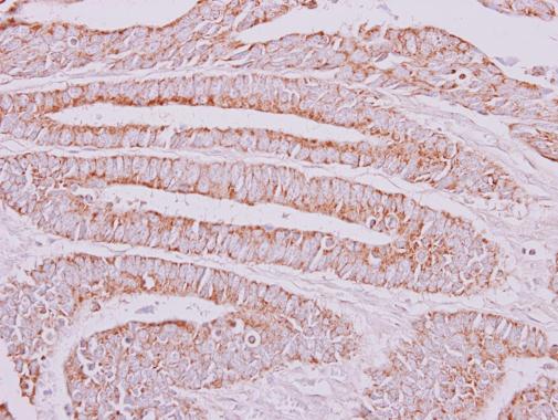Immunohistochemistry (Formalin/PFA-fixed paraffin-embedded sections) - Anti-OXSM antibody (AB229111)