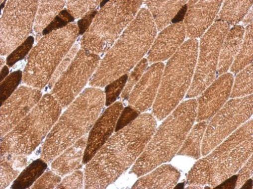 Immunohistochemistry (Formalin/PFA-fixed paraffin-embedded sections) - Anti-OXSM antibody (AB229111)